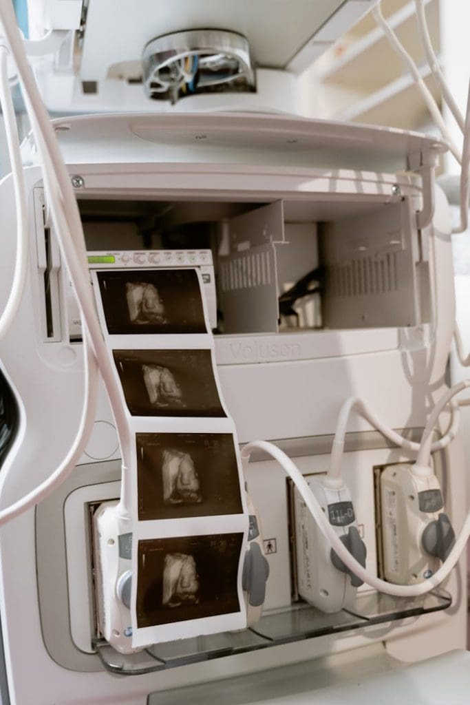 Close-up of an ultrasound machine displaying three ultrasound scans, showcasing modern medical technology in a diagnostic setting.